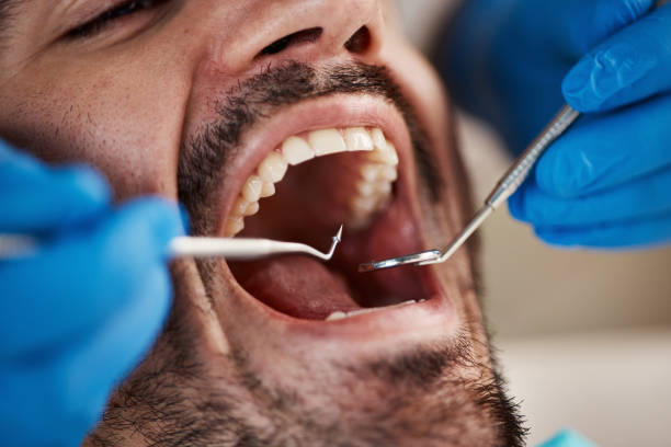 Best Emergency Dental Care for Broken or Chipped Teeth in Wrightsville Beach, NC